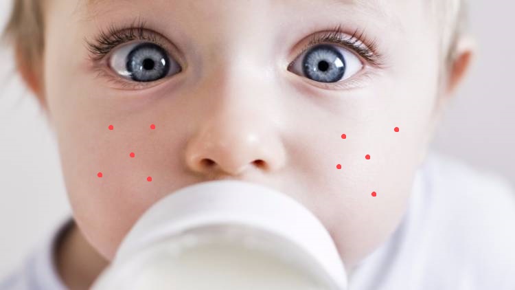 Аллергия у ребенка на лице