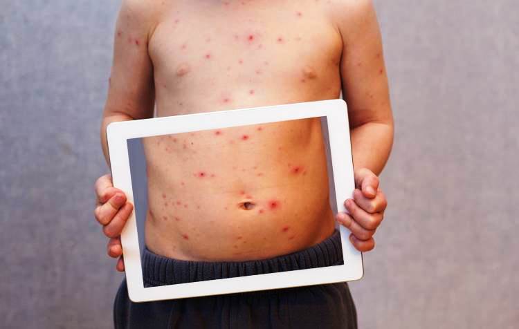 Аллергия в виде сыпи на теле у взрослого